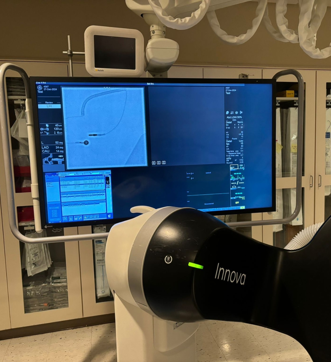 2016 GE IGS 540 Cath Lab